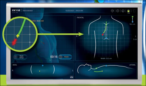 Inline Image